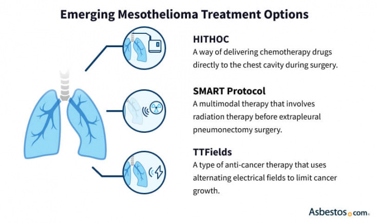 The lastest mesothelioma treatment options