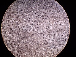 Microscope view of confluent human peritoneal mesothelial cells.