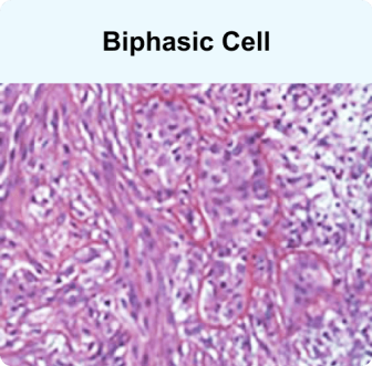 Biphasic cell, a mesothelioma cell type