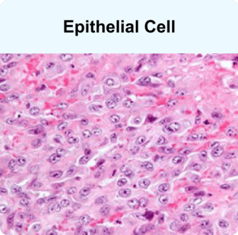 Epithelial Cell, a mesothelioma cell type