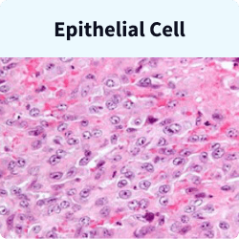 Epithelial cells