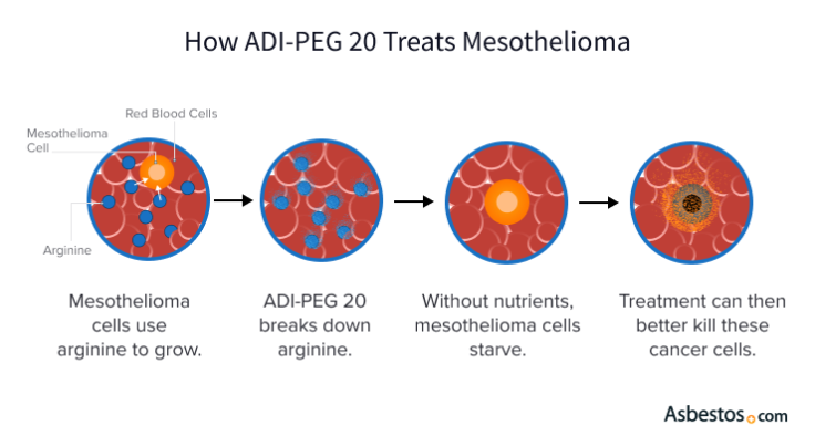 HowADI-PEG 20 Treats Mesothelioma