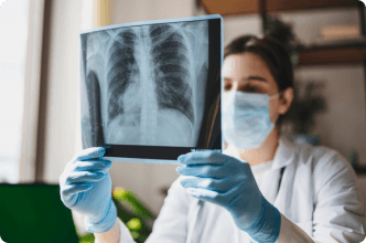 Doctor looking at x-ray of lungs